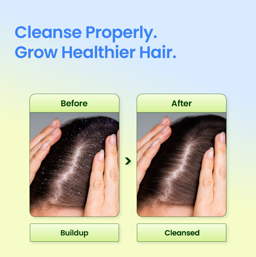 Scalpy Shampoo Voluminizador Root Vital
