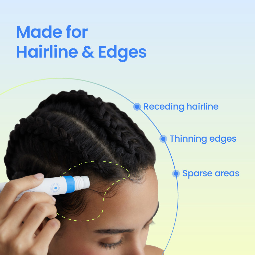 [2 Meses de Cuidado Intensivo] Scalpy Hair Serum 3+1