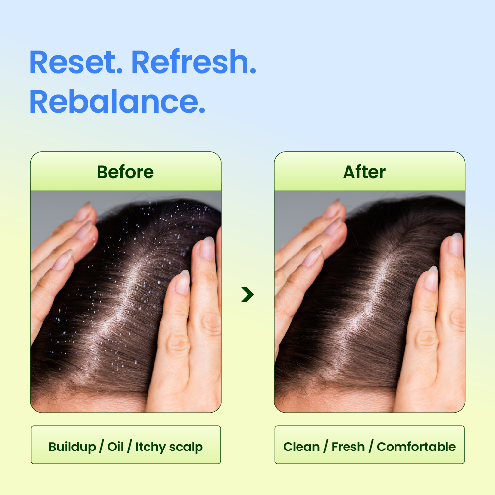 Full Scalp Routine Set