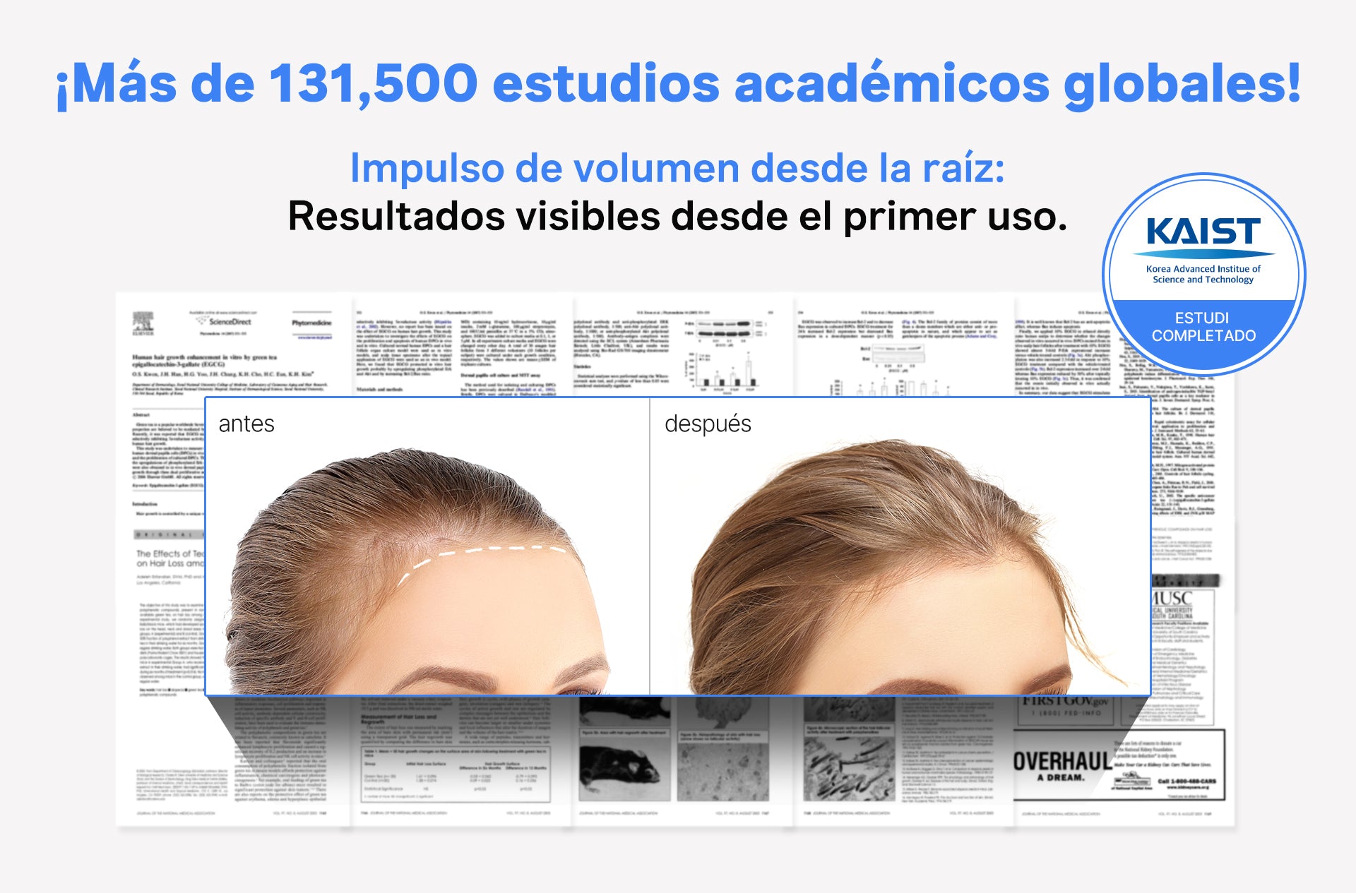 Scalpy Shampoo Voluminizador Root Vital